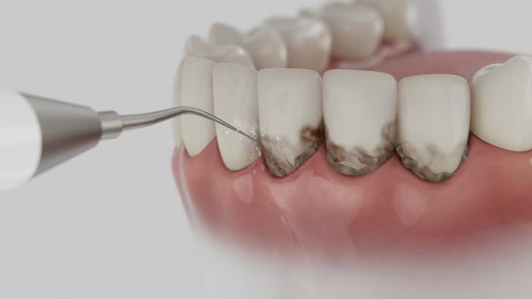 Reliable Dental Implants contractor in Arlington, NY by Smile Center Dentistry